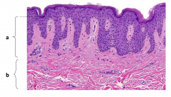 Two layer of dermis