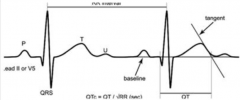- Use lead II or V5 (these give you the best T waves)
- Draw a line tangent to steepest slope of T wave so that it crosses baseline (tangent)
- Measure from first dip of Q wave to tangent = QT interval
- Corrected QT interval: QTc = QT / √RR