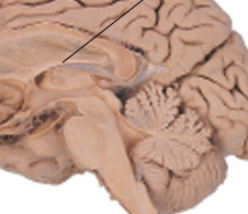 On brain cross-section, inferior arch
