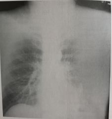 What is the correct critique of the CR image shown in Figure 4-17? 