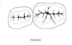 Describe the crown of the primary teeth 