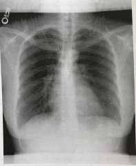 The radiograph shown in Figure 4-12 demonstrates an example of 