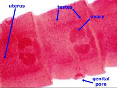 Taenia


Phylum: Platyhelminthes
Class: Cestoda
