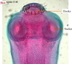 Taenia - slide of scolex


Phylum: Platyhelminthes
Class: Cestoda