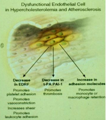 - ↓EDRF → platelet adhesion, vasoconstriction, ↑shear, leukocyte adhesion
- ↓t-PA:PAI-1 → promotes thrombosis
- ↑Adhesion molecules → monocyte and macrophage retention