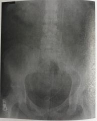 What is the correct critique of the CR image shown in Figure 4-3?