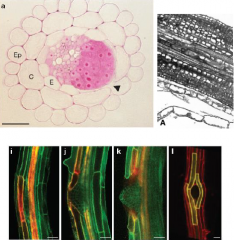 •Lateral root emergence requires separation of overlaying cells.
•Auxin is promotes cell separation.
Radish lateral root primordia treated with auxin. cortical cell layers have been sloughed off leaving only the pericycle surrounding the vascu...