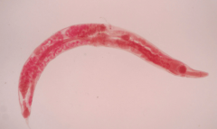 Enterobius Vermicularis
(Pinworms)


Phylum: Nematoda
