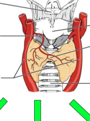 Identify the following anatomical features and the three major functions of the thyroid:
 
Superior thyroid artery, trachea, common carotid arteries, thyroid cartilage, hyoid bone, trachea isthmus of the thyroid