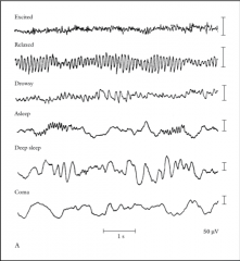 Neural markers of attentive state 
 
What does this image show and what is one of the things that this EEG picks up very nicely?
