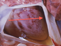 Around the heart. Invaginated sac in the heart's base. Fibrous layer and serous layer. Partially inflated balloon if the heart is the rock pushing on it.