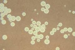 1. LP is absolutely essential if meningitis is suspected. Latex agglutination detects cryptococcal antigen in the CSF. India ink smear shows encapsulated yeasts.
2. tissue biopsy is characterized by lack of inflammatory response
3. The organism ...