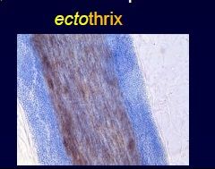 Endothrix refers to dermatophyte infections of the hair that invade the hair shaft and internalize into the hair cell. This is in contrast to exothrix (ectothrix), where a dermatophyte infection remains confined to the hair surface