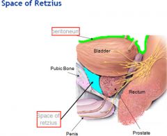 AKA prevesicle or retropubic space

-extraperitoneal pelvic space
-btw ant wall of bladder and symphysis pubis