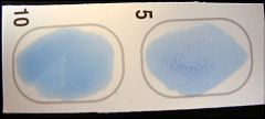 The Group A latex reagent was applied to the circle on the left, and the Group B latex reagent was applied to the circle on the right. Identify the bacteria being tested.