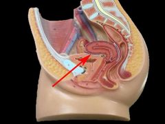 Between bladder & anterior uterus