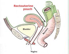 In between posterior uterus & rectum