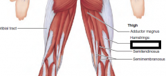 Extends thigh and flexes
knee;

O—ischial tuberosity
(long head); linea aspera,
lateral supracondylar
line, and distal femur
(short head)
I—common tendon
passes downward and
laterally (forming lateral
border of popliteal
fossa) to ...