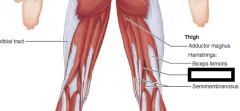 Extends thigh and
flexes knee

O—ischial tuberosity in
common with long head
of biceps femoris
I—medial aspect of
upper tibial shaft