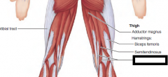 Extends thigh and flexes
knee;

O—ischial tuberosity
I—medial condyle
of tibia; via oblique
popliteal ligament to
lateral condyle of femur