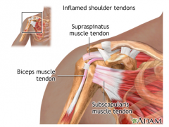 Also called intertubercular sulcus
 
Biceps tendon passes through here