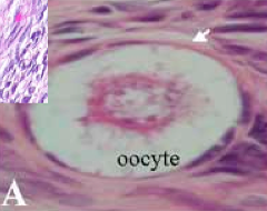 - Primordial follicles located peripherally
- Surrounded by a single layer of SQUAMOUS follicular cells (arrow)