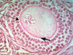 - Cuboidal follicular cells in either a single layer (unilaminar) or multiple layers (multilaminar)
- Zona Pellucida - homogenous, eosinophilic, non-cellular layer of glycoproteins and proteoglycans residing just inside the innermost layer of fol...