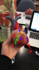 Anterior view

1. superior vena cava
2. inferior vena cava
3. aorta

4. pulmonary trunk
5. right atrium

6. right ventricle

7. left ventricle

8. auricle of right atrium
9. auricle of left atrium
10. apex of the heart