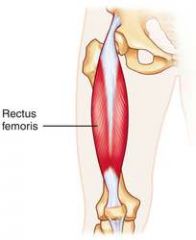 Front of the thigh toward the midline of the leg
