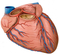 Label the relevant V. on this view of the heart