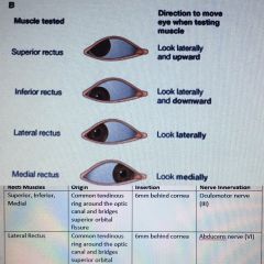 MUSCLES OF THE EYE 1

4 RECTI MUSCLES

- Superior & inferior reci produce unwanted medial rotations. 

- Recti muscles pull the orbit back.





