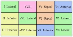 Anterior wall: ST elevations and hyperacute T waves appear in one or more of V1-V6 and I, aVL; ST depressions in II, II and AVF
Inferior wall: ST elevations and hyperacute T waves are seen in II, II and aVF; ST depressions in V1 to V3, I and AVL