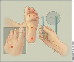 What is the most important test to do with a diabetic patient with concerns of neuropathy?