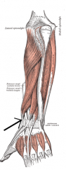 Origin: radius, ulna, interosseous membrane
Insertion: proximal phalanx of pollex
Action: extends 1st metacarpal-phalangeal joint