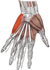 Origin: lateral epicondyle
Insertion: distal phalanx of 5th digit
Action: extends 5th distal interphalangeal joint