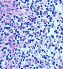 Lymphocytes. Appear as naked nuclei because of limited amounts of cytoplasm