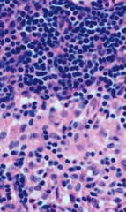 Lymph node: lymphocytes on top and macrophages on bottom