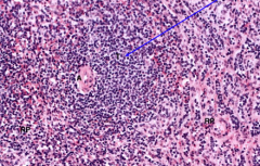 Splenic lymphoid tissue: White pulp (area containing lymphocytes suspended on reticular fibers and involved in immune function), T cell zone