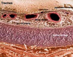 Trachea - epithelium, basement membrane, lamina propria, hyaline cartilage, and adventitia