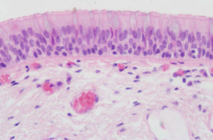 Trachea - respiratory epithelia, ciliated pseudostratified with goblet cells