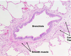 Bronchiole - smooth muscle and connective tissue