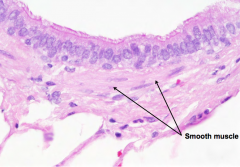 Bronchiole - simple, columnar ciliated epithelium