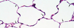 Alveoli with elastic fibers stained