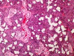 Parotid gland, Serous acinar cells and lots of adipose