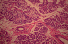 Submandibular gland with mixed mucous and serous cells and less adipose tissue