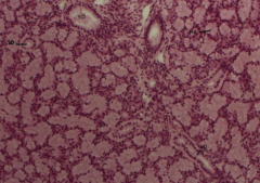 Sublingual gland with only mucous acini