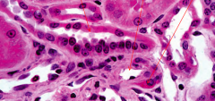 Distal tubule, afferent arteriole, and juxtaglomerular cells with renin granules