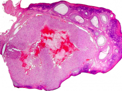 Ovary with follicles