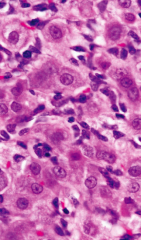 Corpus luteum, foamy cytoplasm contains progesterone