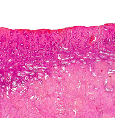 Proliferative endometrium (uterus) Stratum compactum, stratum spongiosum, stratum basalis, myometrium